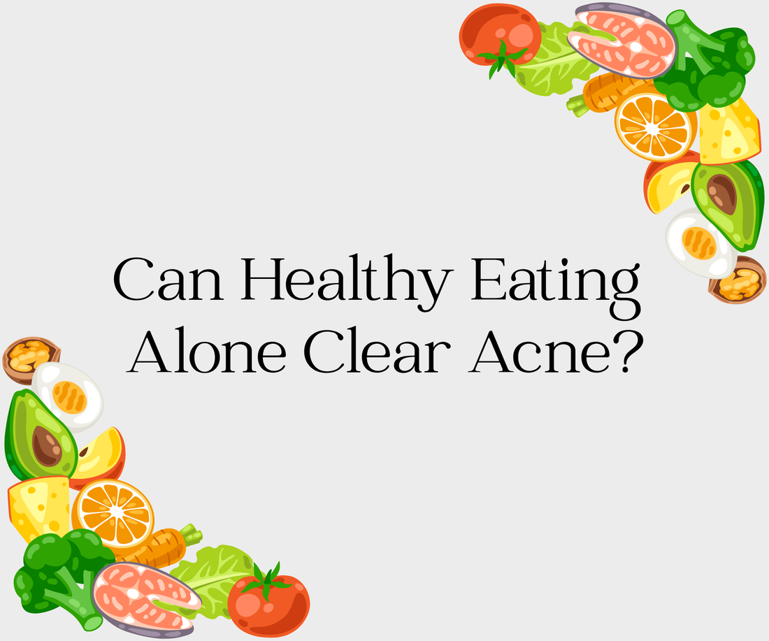 Can Healthy Eating Alone Clear Acne?